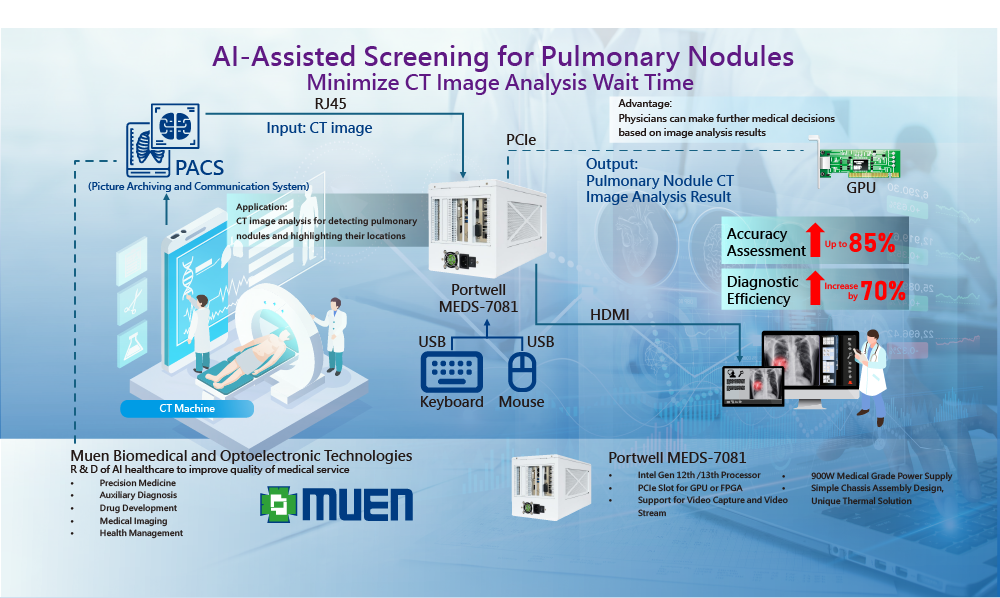 AI-Assisted Screening for Pulmonary Nodules