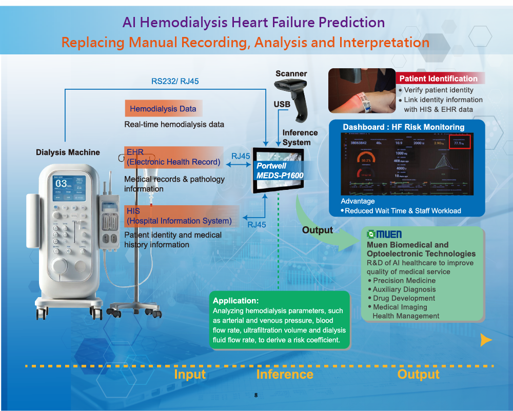 AI Hemodialysis Heart Failure Prediction